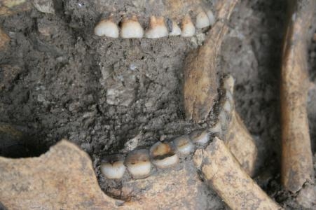 Human and animal tooth wear analysis