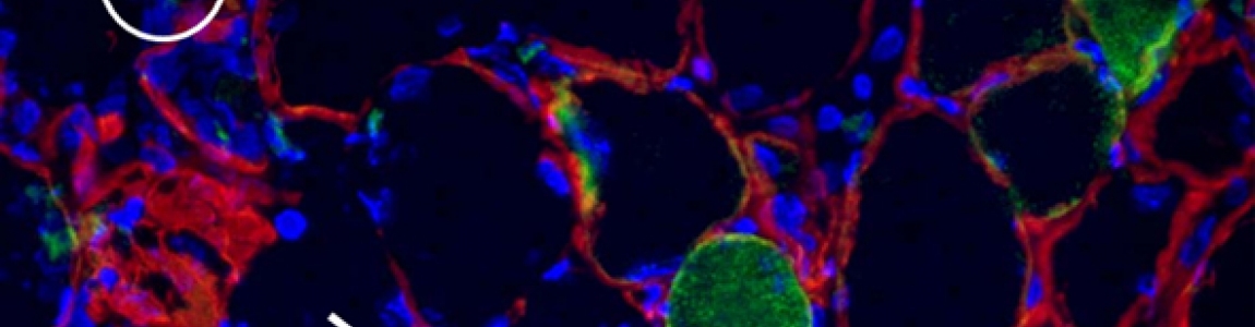 muscolo scheletrico rigenerante - regenerating skeletal muscle